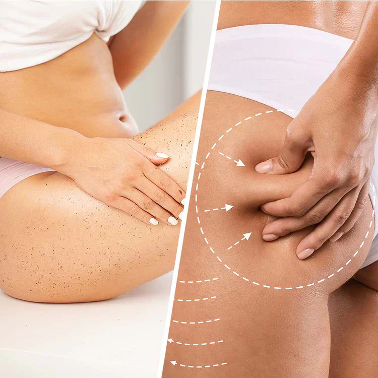 Niacin proticelulitni piling s kokosom za upravo in glajenje kože 250 ml