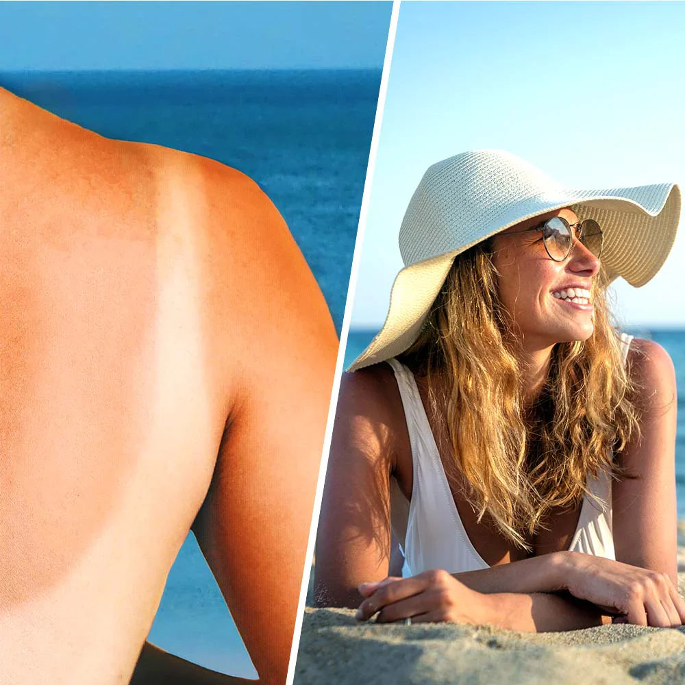 Pomožni losjon s hialuronsko kislino po soncu - 200 ml