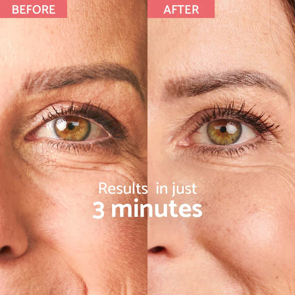 Remescar Instant Wrkle Corrector - korektor gub s takojšnjim učinkom (180 aplikacij)