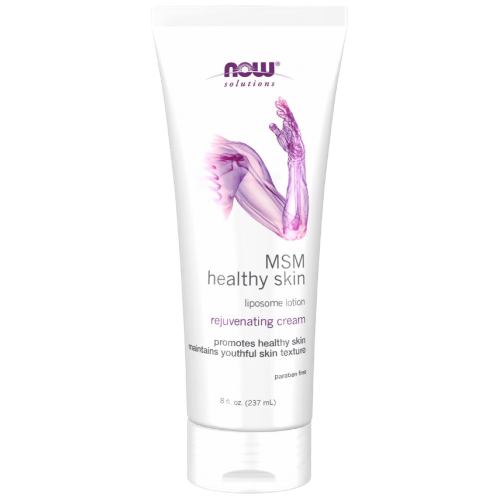 MSM Zdrava koža | Losjon za liposom - 237 ml